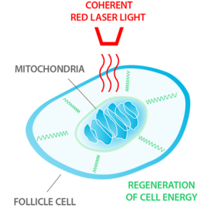 Laser Hair Growth Therapy